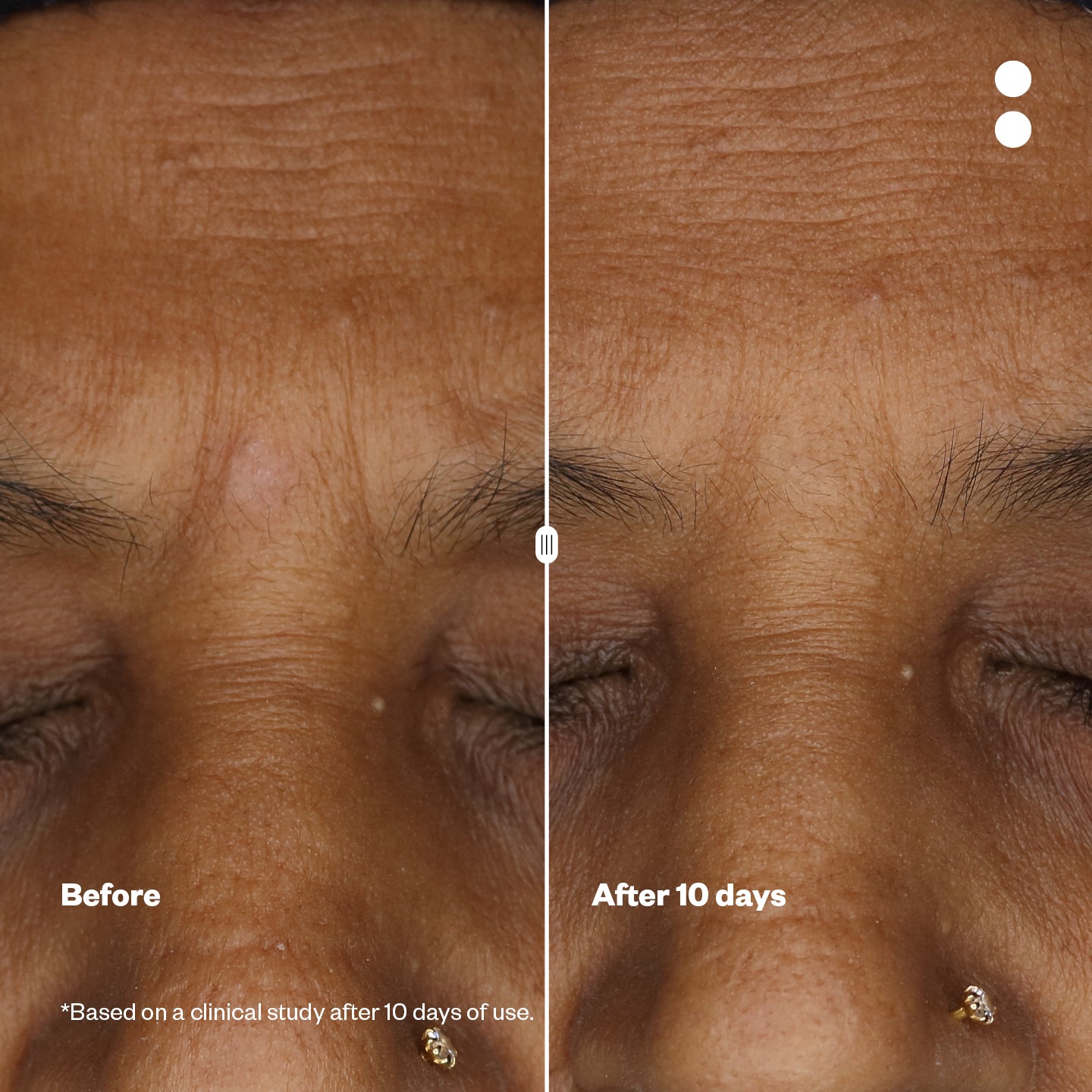 Microshots™ - Vogue Award-winning AgeDefying Peptide⁶ Cream