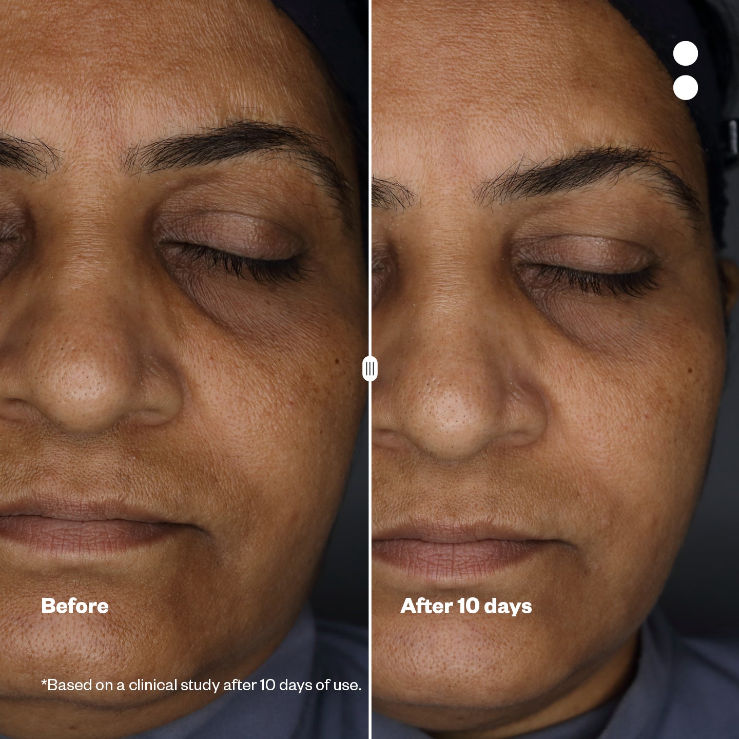 Microshots™ - Vogue Award-winning AgeDefying Peptide⁶ Cream