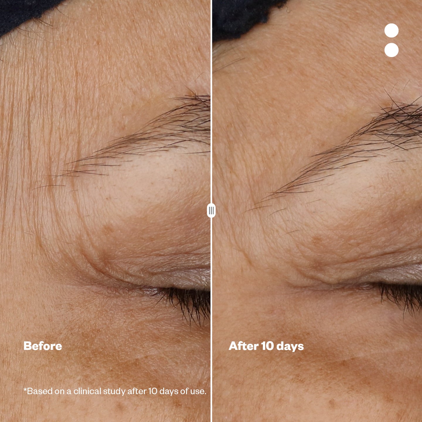 Microshots™ - Vogue Award-winning AgeDefying Peptide⁶ Cream